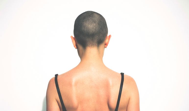 Jada Pinkett Smith Hair Loss: The Causes, Symptoms and Treatment