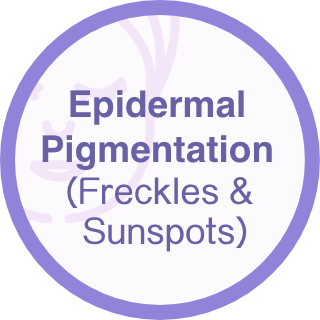Epidermal Pigmentation(Freckles & Sunspots)