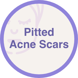 Pitted Acne Scars