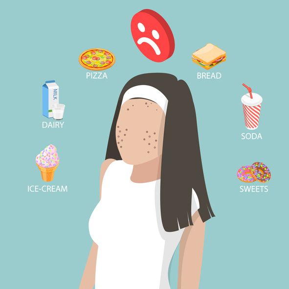 /uploads/acne_myths_1_c14105d3de.jpg