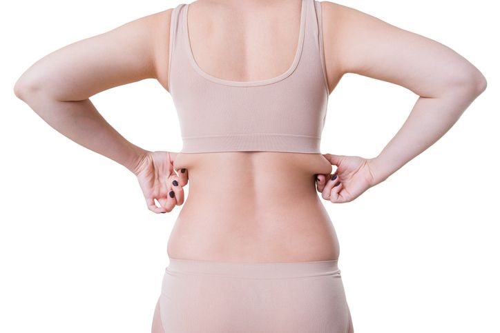 7 Common Myths About Back Fat — Debunked by Medical Experts