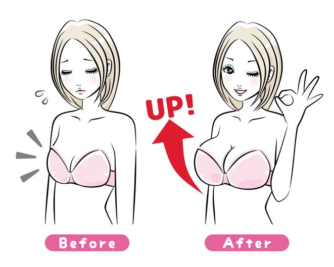 Breast Augmentation Surgery Recovery: What you Need to Know!