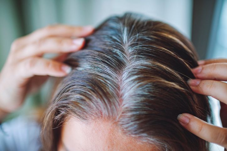 10 Early Signs of Crown Thinning Hair: How to Detect Hair Loss Before It Worsens