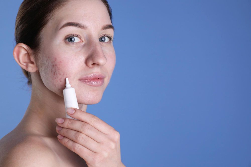 /uploads/does_tretinoin_help_with_acne_1_f4b2f76292.jpg