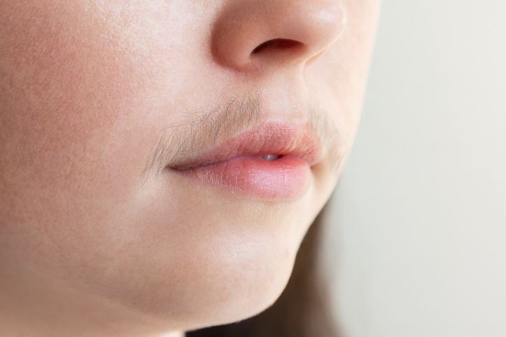 Top things you need to know about facial hair removal methods!
