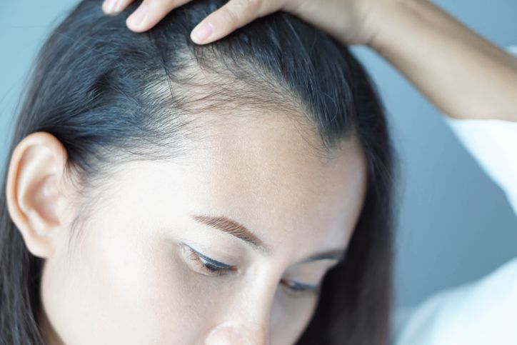 /uploads/frontal_baldness_1_122208e269.jpg