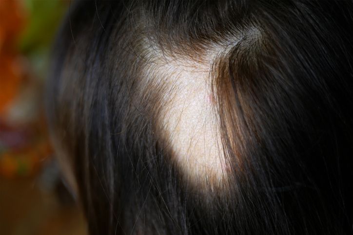 Is your hair thinning? Here are 10 proven causes of hair loss you need to tackle now!