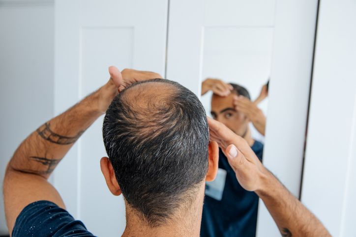 What is the best method to reduce hair loss?