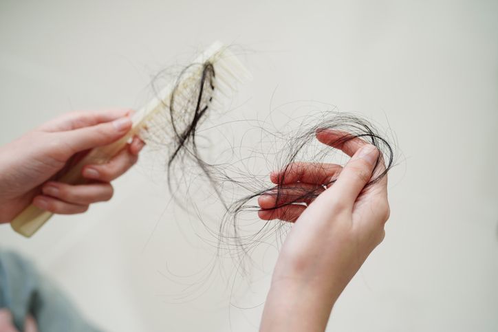 Get to know what causes hair loss and how you can treat them