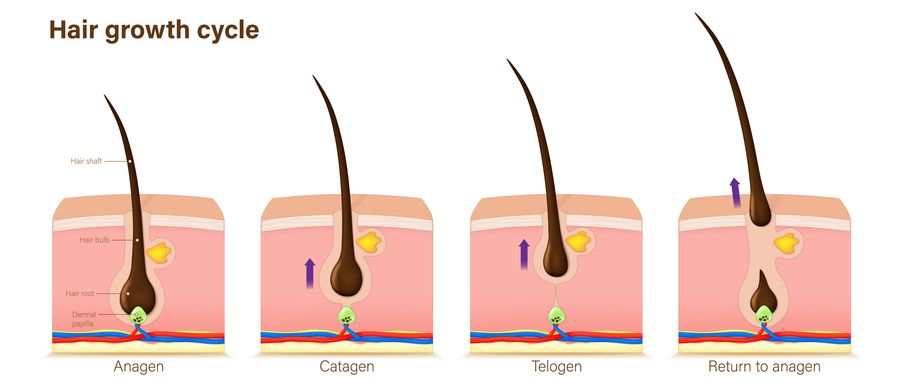 What Triggers Hair Miniaturization? 6 Real Solutions to Slow Hair Loss and Boost Hair Growth Naturally