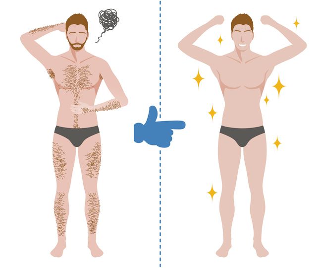 A Handy Guide About Permanent Hair Removal for Men in Singapore