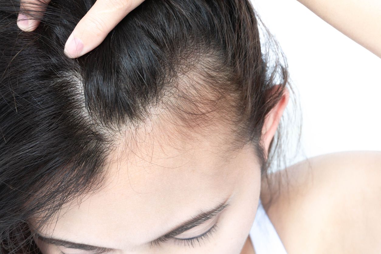 Eat to Beat Hair Loss: 10 Nutrient-Rich Foods That Help Stop Hair Shedding and Thinning