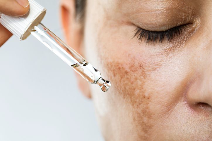 /uploads/niacinamide_for_dark_spots_1_c8ee6023d0.jpg
