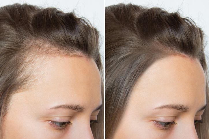 /uploads/omega_3_for_hair_1_da8a03a38b.jpg
