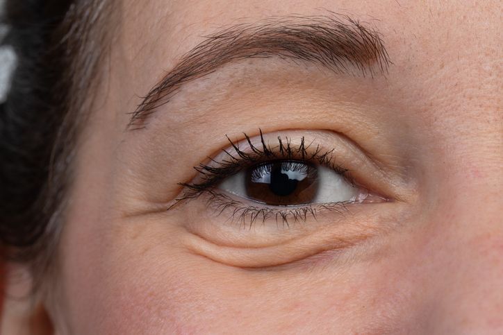/uploads/puffy_eyes_remedy_1_b5be5d3c79.jpg