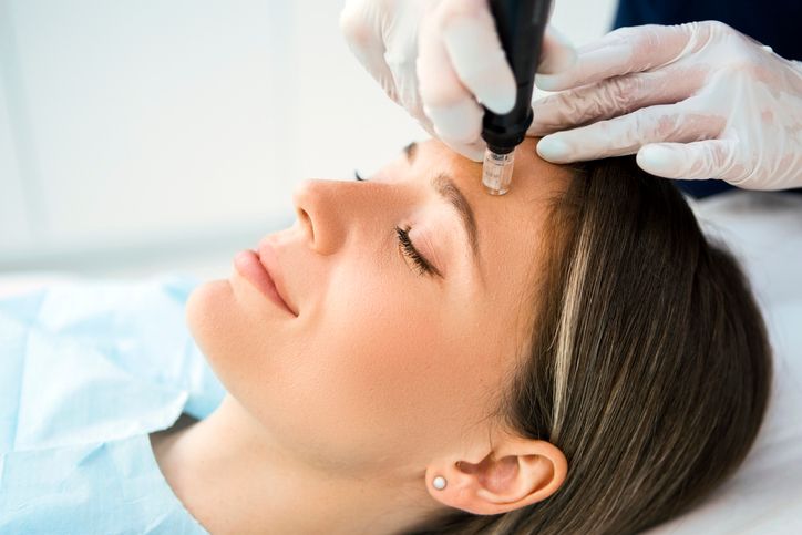 /uploads/skin_needling_benefits_1_a398c3f15d.jpg