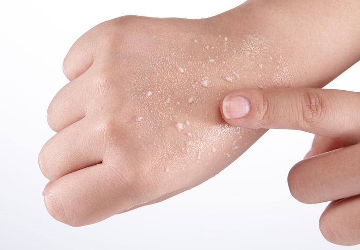 /uploads/smooth_skin_1_ed49212b56.jpg