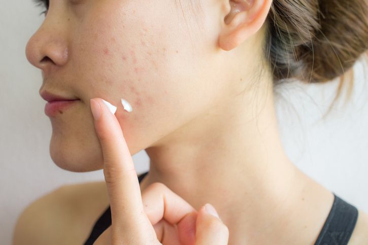 Spot treatment that works wonders for your skin!