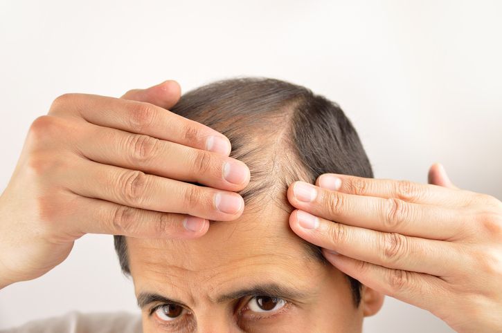 5 Tips to Help Cure Your Hair Loss