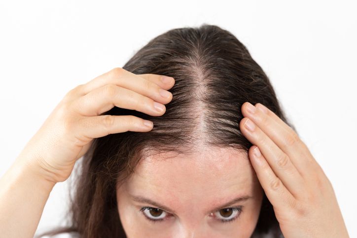Effective Hair Loss Treatments: A Comprehensive Guide